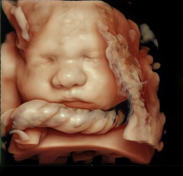 Imagem do feto em 3D